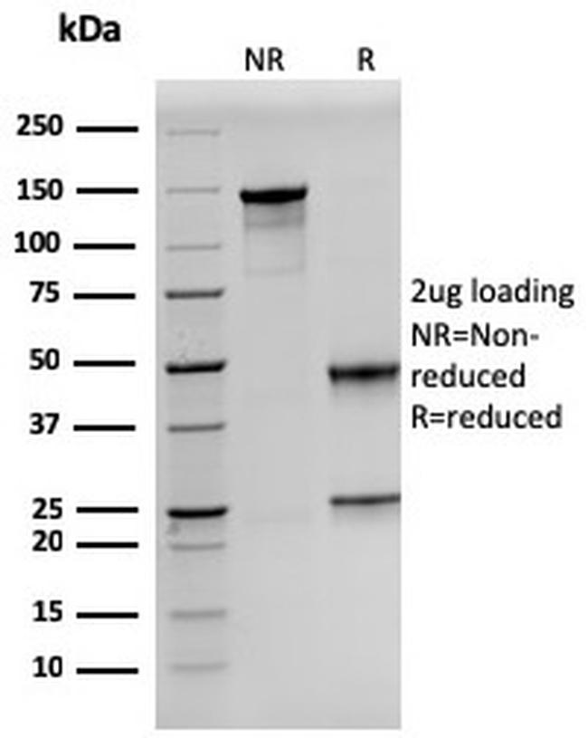 Prolactin Antibody in SDS-PAGE (SDS-PAGE)