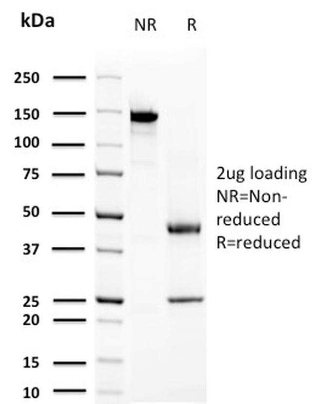 Prolactin Antibody in SDS-PAGE (SDS-PAGE)