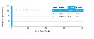 Prolactin (Pituitary Tumor Marker) Antibody in Peptide array (ARRAY)