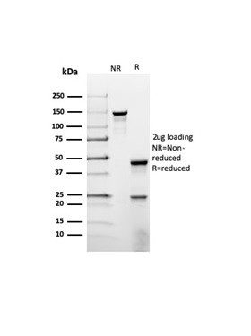 Prolactin (Pituitary Tumor Marker) Antibody in SDS-PAGE (SDS-PAGE)