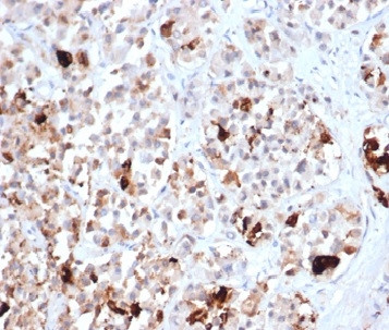 Prolactin (Pituitary Tumor Marker) Antibody in Immunohistochemistry (Paraffin) (IHC (P))