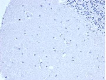 Prolactin (Pituitary Tumor Marker) Antibody in Immunohistochemistry (Paraffin) (IHC (P))