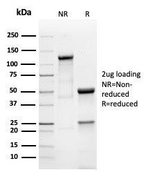 Prolactin (Pituitary Tumor Marker) Antibody in SDS-PAGE (SDS-PAGE)