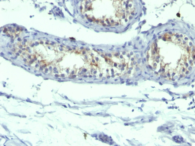 Prolactin Receptor (hPRL Receptor) Antibody in Immunohistochemistry (Paraffin) (IHC (P))