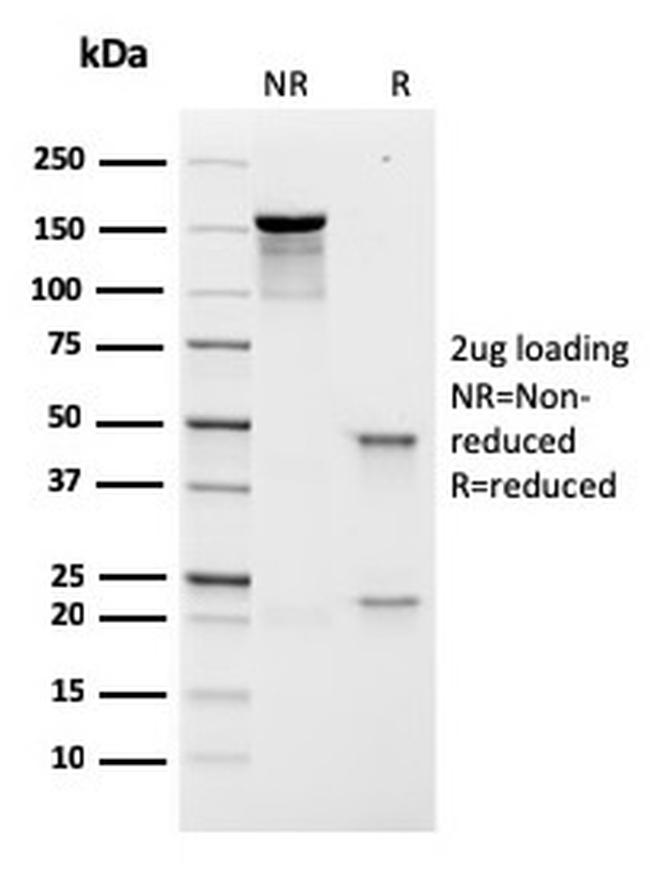 Prolactin Receptor (hPRL Receptor) Antibody in SDS-PAGE (SDS-PAGE)