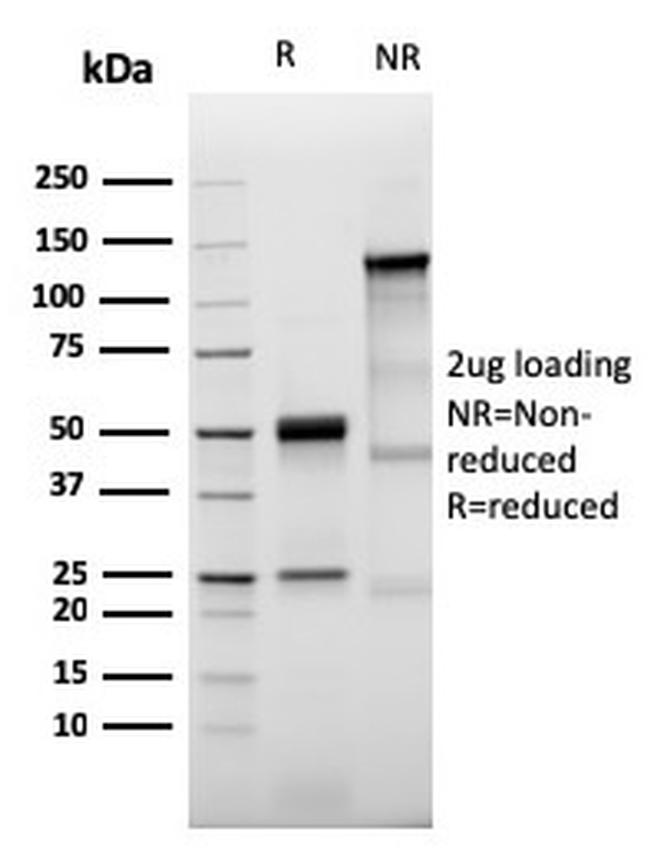 Prolactin Receptor (hPRL Receptor) Antibody in SDS-PAGE (SDS-PAGE)