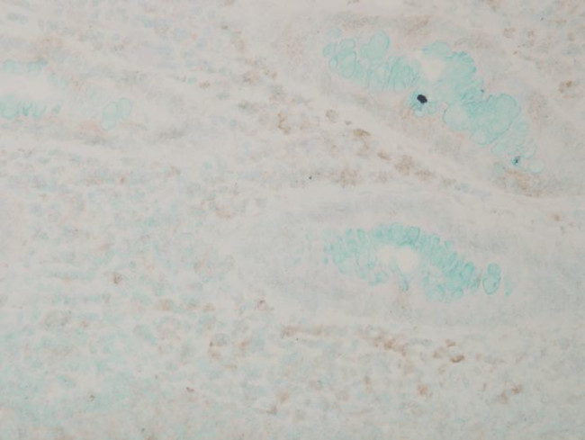 p38 alpha MAP Kinase Antibody in Immunohistochemistry (PFA fixed) (IHC (PFA))