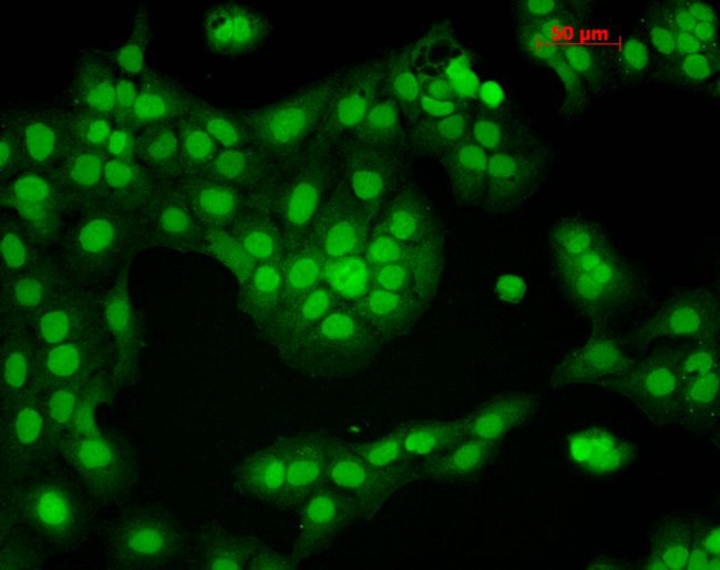 CaMKII Antibody in Immunocytochemistry (ICC/IF)