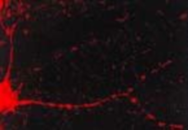 CaMKII Antibody in Immunocytochemistry (ICC/IF)