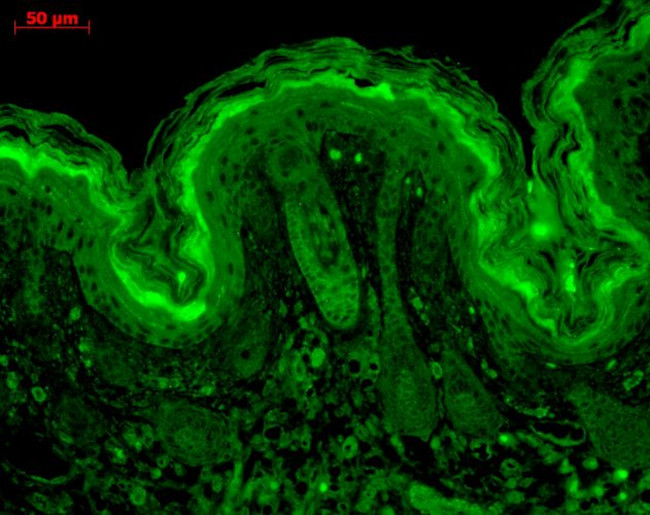 CaMKII Antibody in Immunohistochemistry (Paraffin) (IHC (P))