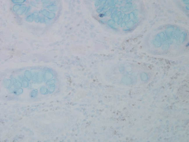 Nitrotyrosine Antibody in Immunohistochemistry (PFA fixed) (IHC (PFA))