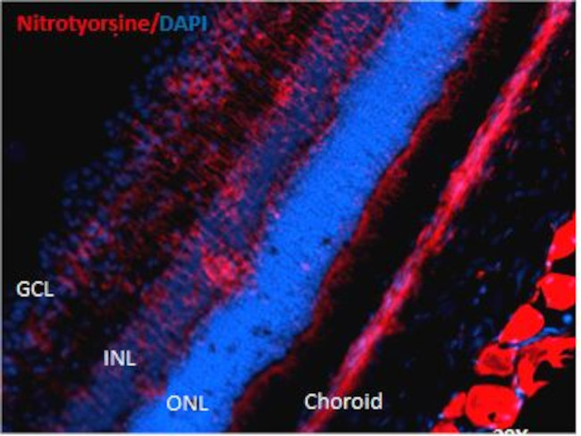 Nitrotyrosine Antibody in Immunohistochemistry (IHC)