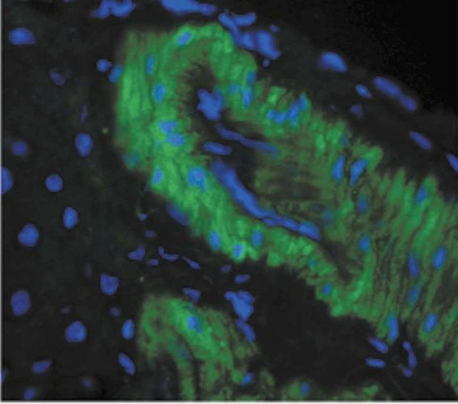 Nitrotyrosine Antibody in Immunohistochemistry (IHC)