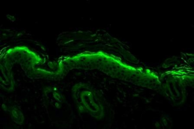 Nitrotyrosine Antibody in Immunohistochemistry (Paraffin) (IHC (P))