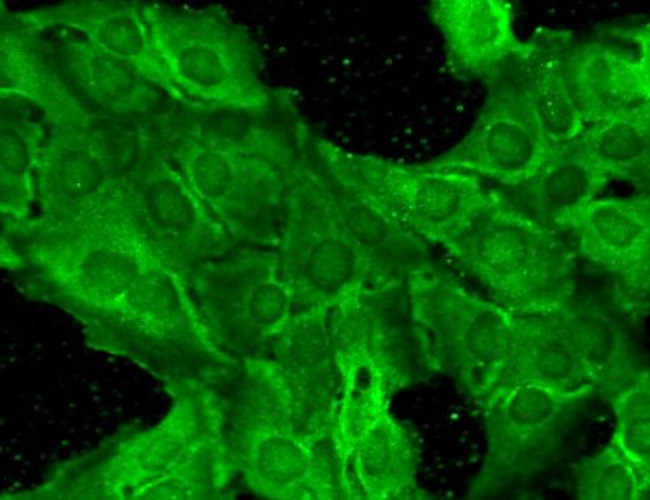 NR2B Glutamate Receptor Antibody in Immunocytochemistry (ICC/IF)