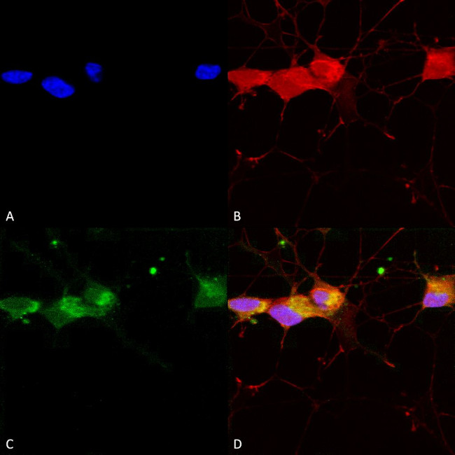 NR2B Glutamate Receptor Antibody in Immunocytochemistry (ICC/IF)