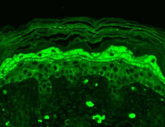 NR2B Glutamate Receptor Antibody in Immunohistochemistry (Paraffin) (IHC (P))