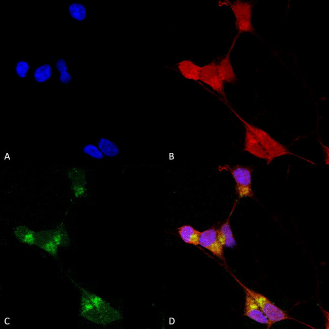 Delta GABA-A Receptor Antibody in Immunocytochemistry (ICC/IF)