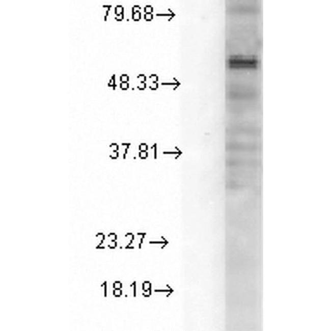Delta GABA-A Receptor Antibody in Western Blot (WB)