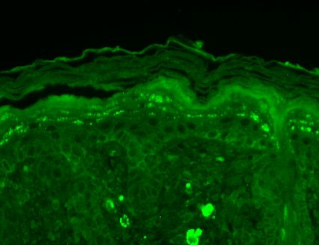 Shank3 Antibody in Immunohistochemistry (Paraffin) (IHC (P))