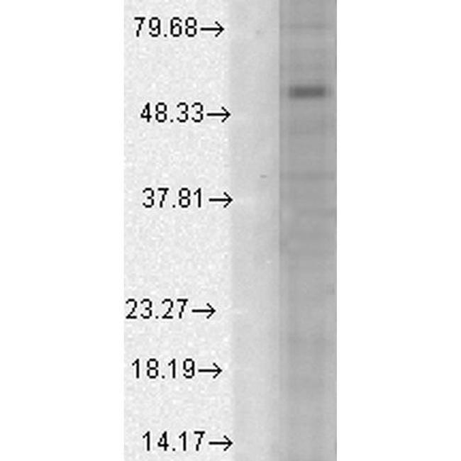 Alpha 1 GABA-A Receptor Antibody in Western Blot (WB)