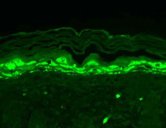 Shank1 Antibody in Immunohistochemistry (Paraffin) (IHC (P))