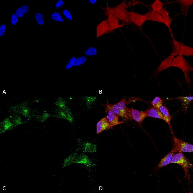 Beta 3 GABA-A Receptor Antibody in Immunocytochemistry (ICC/IF)