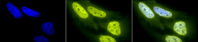 Acetylated Lysine Antibody in Immunocytochemistry (ICC/IF)