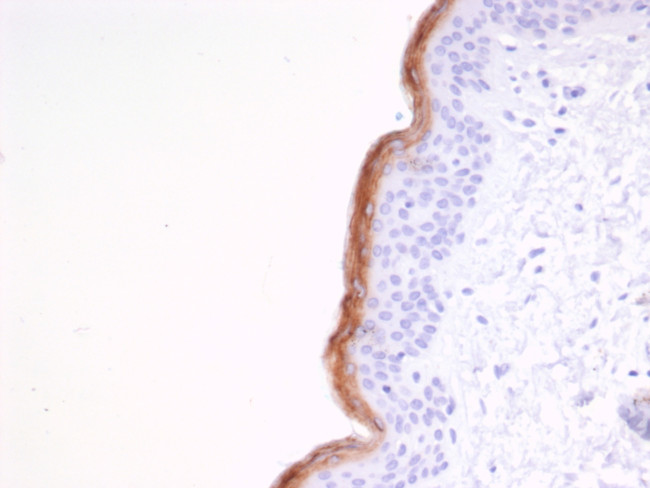 KLK7 (Kallikrein Related Peptidase 7) Antibody in Immunohistochemistry (Paraffin) (IHC (P))