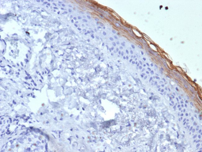 KLK7 (Kallikrein Related Peptidase 7) Antibody in Immunohistochemistry (Paraffin) (IHC (P))