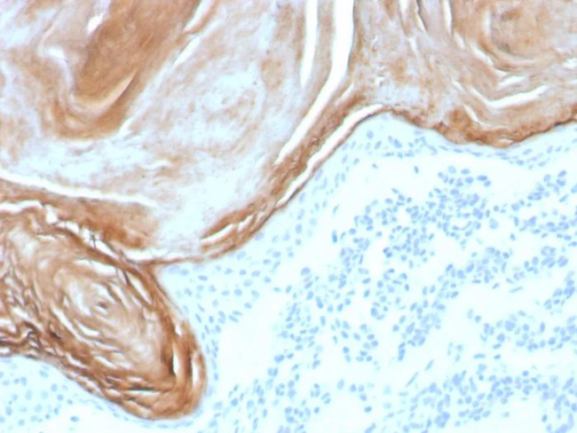 KLK7 (Kallikrein Related Peptidase 7) Antibody in Immunohistochemistry (Paraffin) (IHC (P))