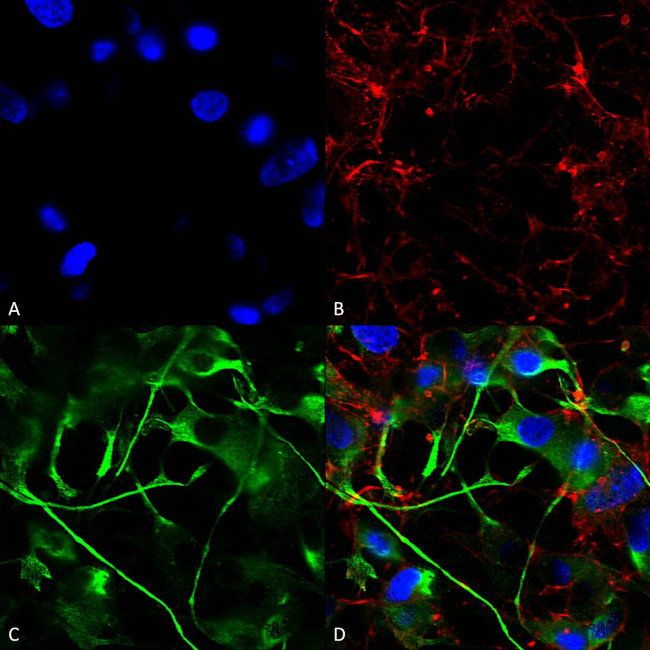 VAChT Transporter Antibody in Immunocytochemistry (ICC/IF)