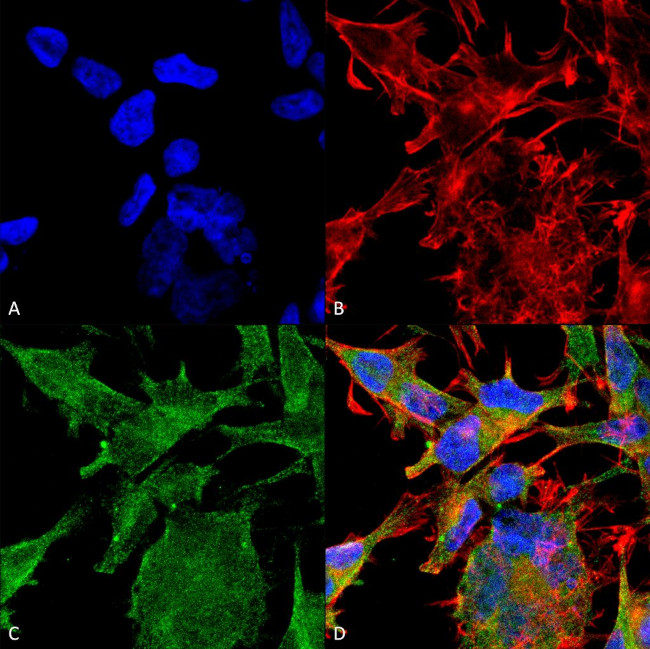 VAChT Transporter Antibody in Immunocytochemistry (ICC/IF)