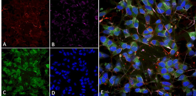 VGlut1 Transporter Antibody in Immunocytochemistry (ICC/IF)