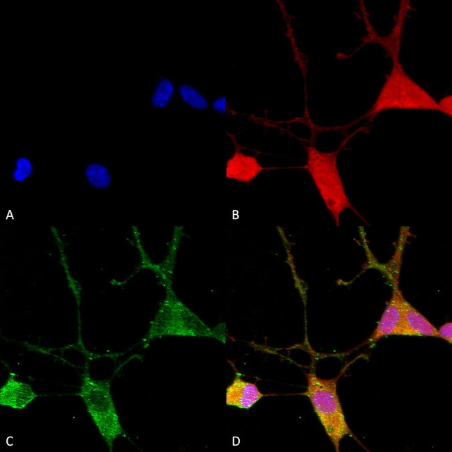 VGlut1 Transporter Antibody in Immunocytochemistry (ICC/IF)