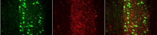 VGlut1 Transporter Antibody in Immunohistochemistry (IHC)