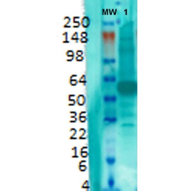 VGlut1 Transporter Antibody in Western Blot (WB)