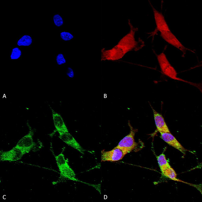 VGlut2 Transporter Antibody in Immunocytochemistry (ICC/IF)