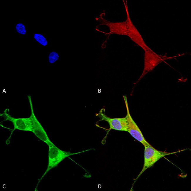 Copper-Transporting ATPase1 Antibody in Immunocytochemistry (ICC/IF)