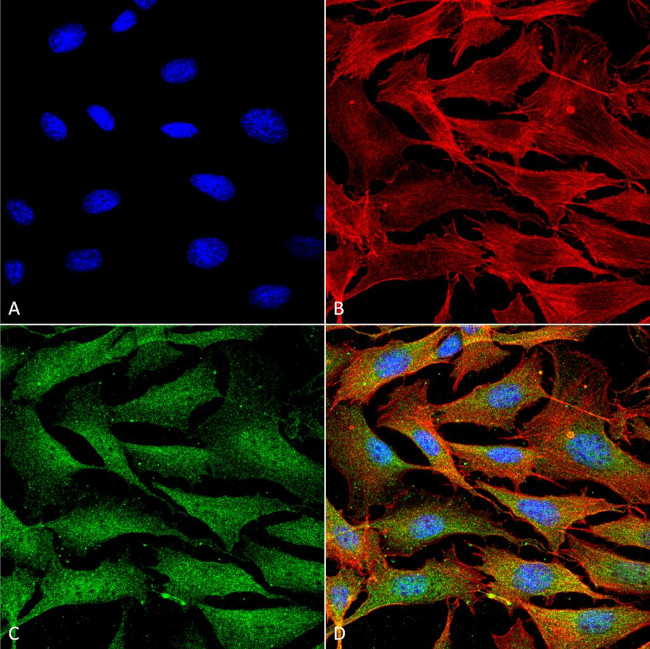 Copper-Transporting ATPase1 Antibody in Immunocytochemistry (ICC/IF)