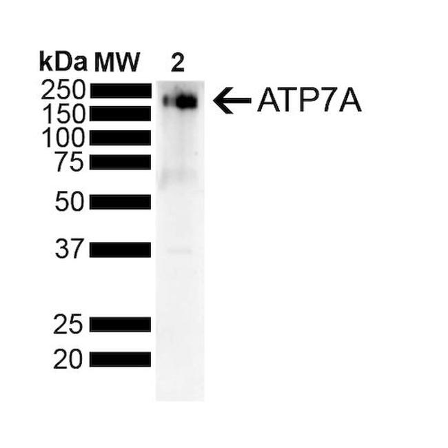 Copper-Transporting ATPase1 Antibody in Western Blot (WB)