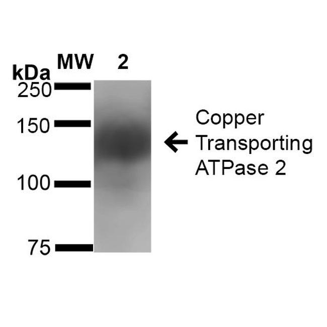 Copper-Transporting ATPase2 Antibody in Western Blot (WB)