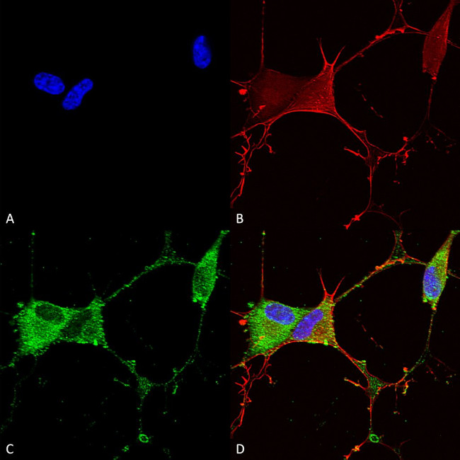 GABA (B)R2 Antibody in Immunocytochemistry (ICC/IF)