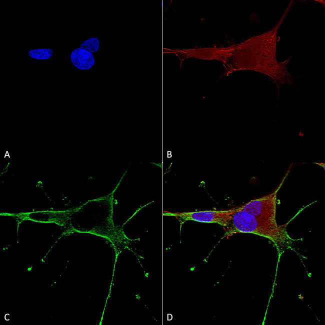 NR1 Glutamate Receptor Antibody in Immunocytochemistry (ICC/IF)