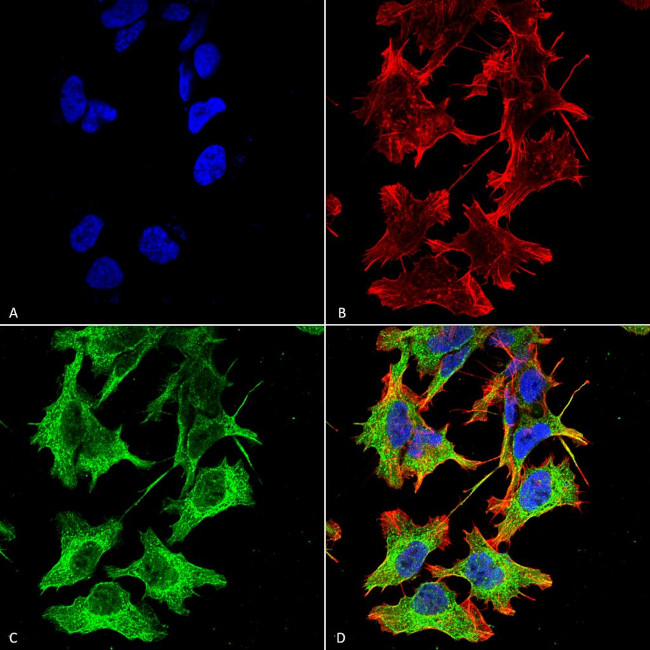 NR1 Glutamate Receptor Antibody in Immunocytochemistry (ICC/IF)