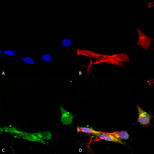 mGluR1/5 Glutamate Receptor Antibody in Immunocytochemistry (ICC/IF)