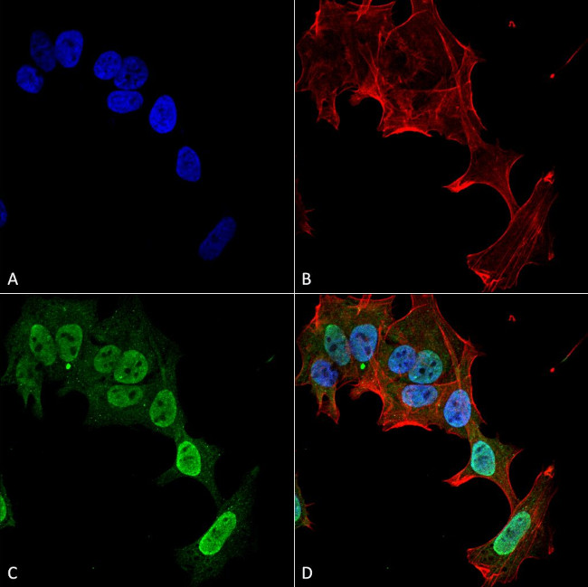 mGluR1/5 Glutamate Receptor Antibody in Immunocytochemistry (ICC/IF)