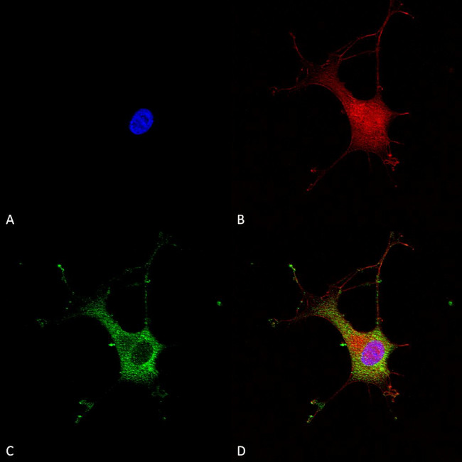 Alpha-2C Adrenergic Receptor Antibody in Immunocytochemistry (ICC/IF)