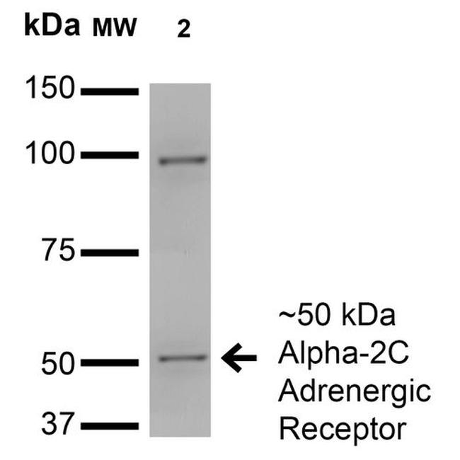 Alpha-2C Adrenergic Receptor Antibody in Western Blot (WB)