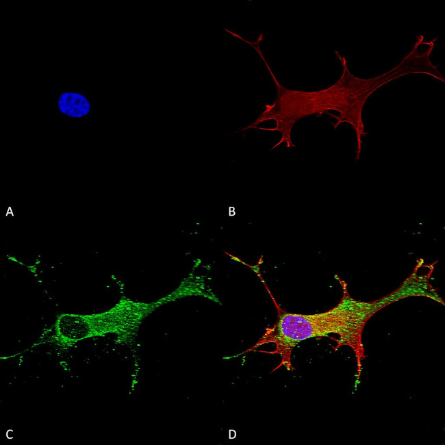 Notch1 Antibody in Immunocytochemistry (ICC/IF)